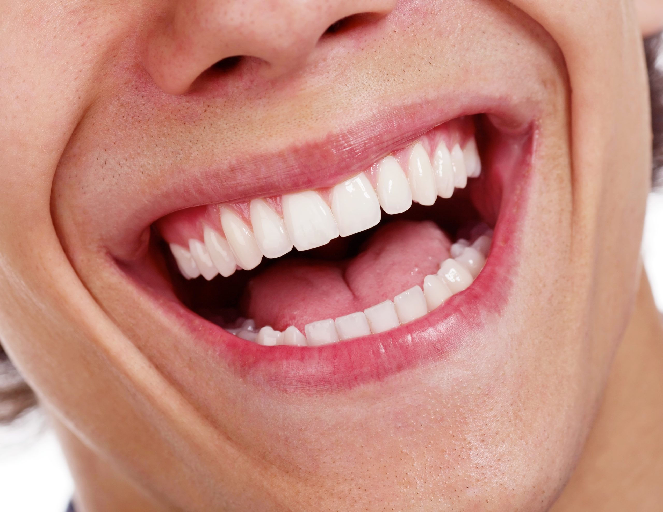 Male smiling with white teeth