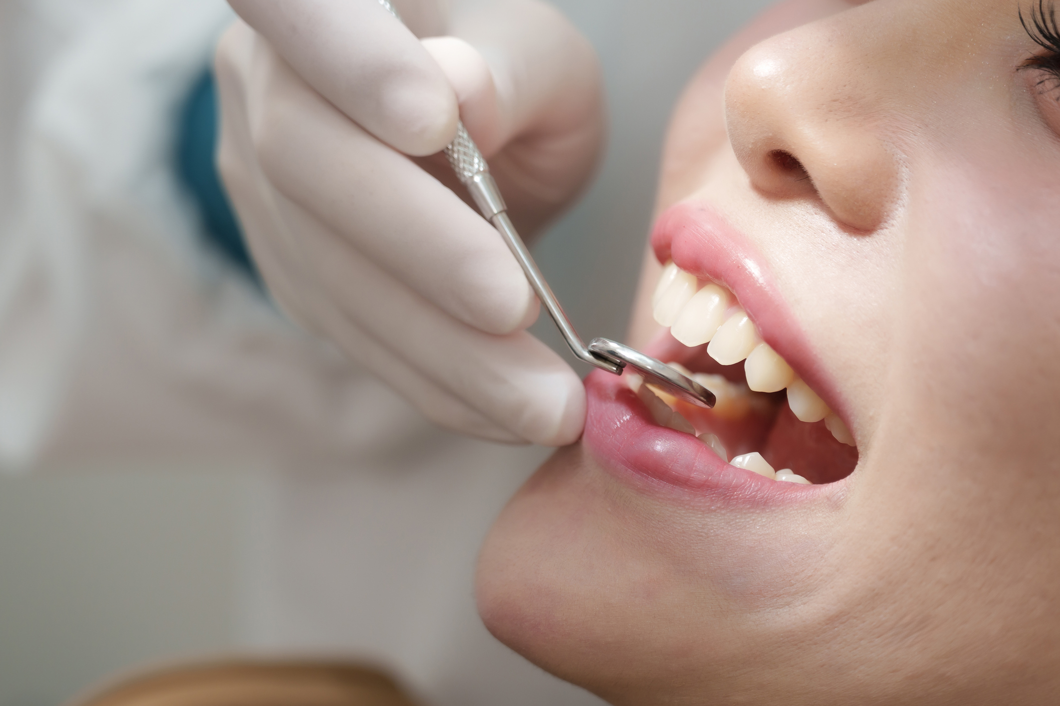 Famle being examined by the dentist