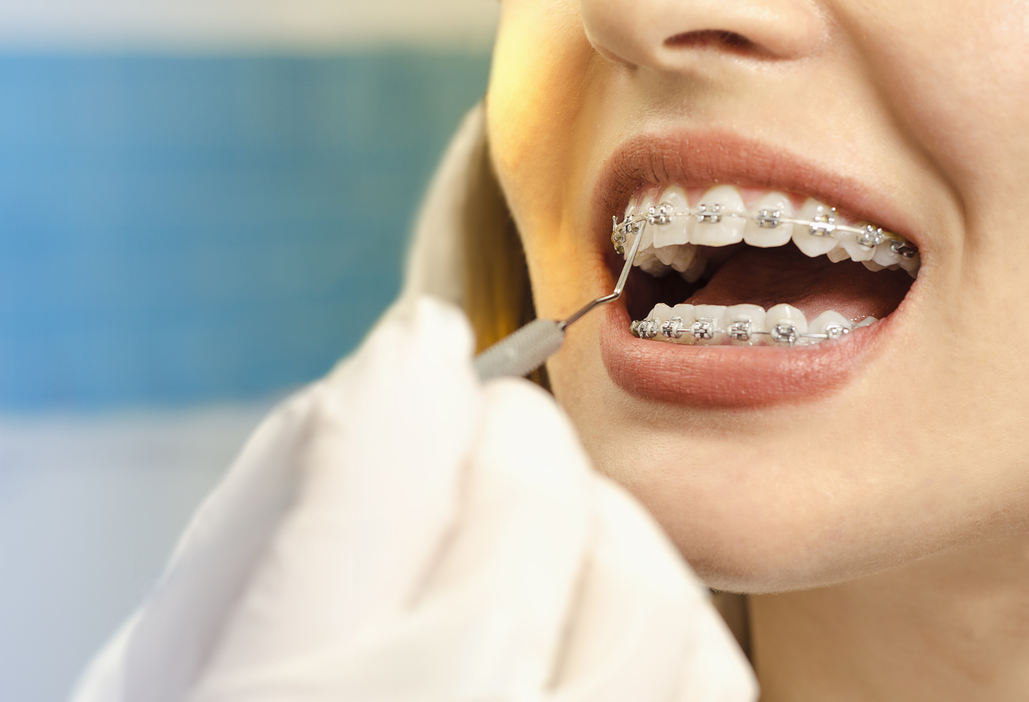 Patient having their braces examined