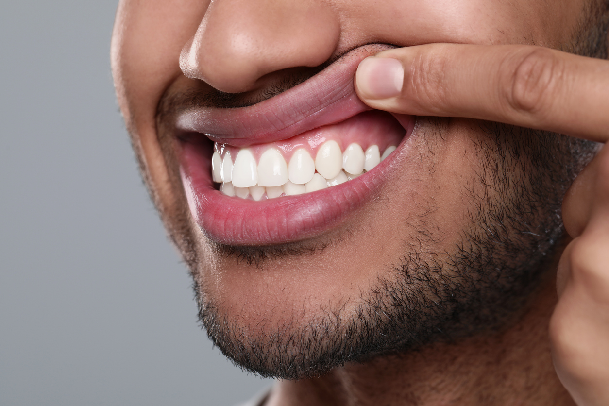 Dental patient with healthy gums