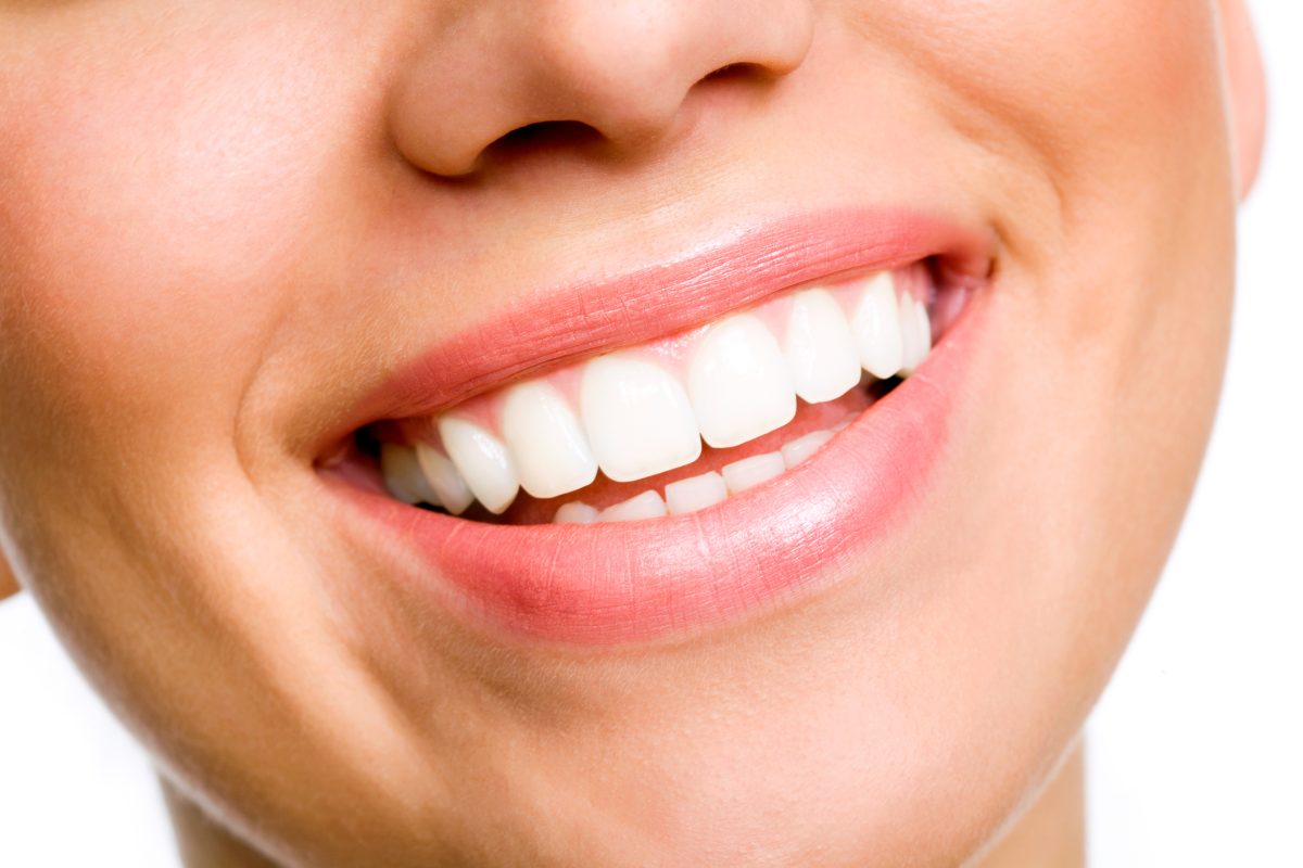 Downgrade rule that affects white fillings